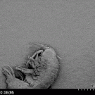 A bacterium on a diatom on an amphipod