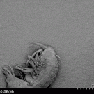 A bacterium on a diatom on an amphipod