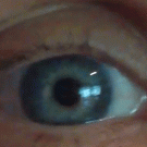 Eye capillaries spell
