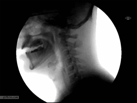 1315245829_drinking_water_xray.gif
