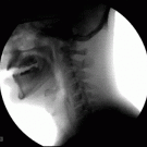Drinking water x-ray