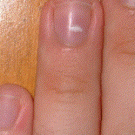 Time lapse growing finger nail